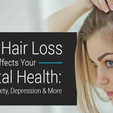 Coping with Hair Loss in Your 20s: Mental Health and Self-Image Tips