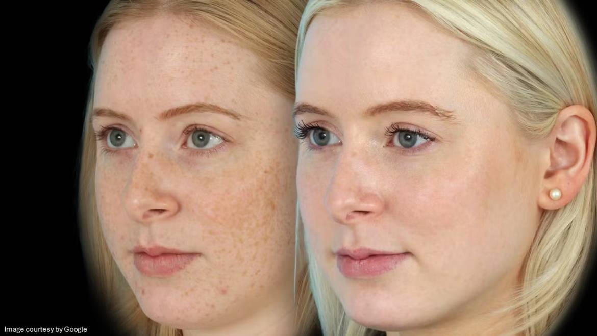Common mistakes people make when using Melalite Forte Cream