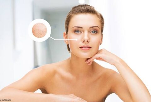 Dead Skin Builds Up