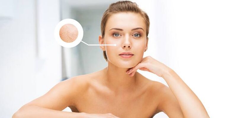 Dead Skin Builds Up