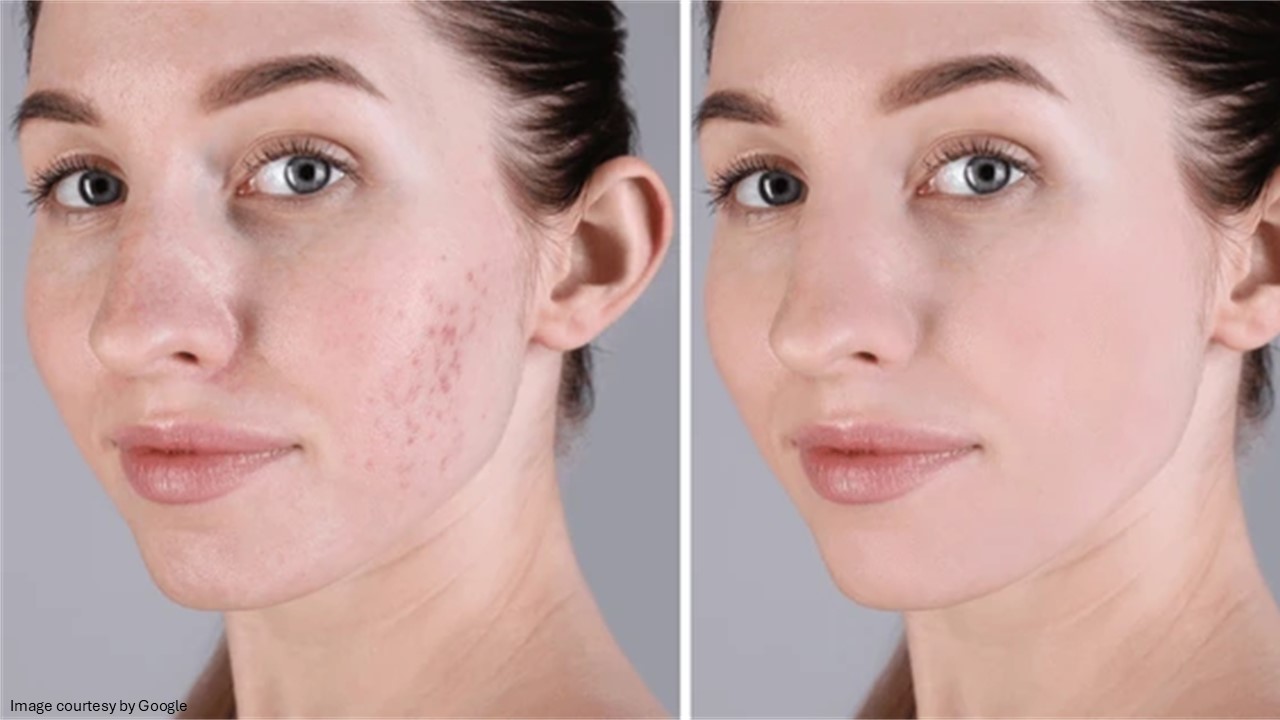 Before and after of a lady face