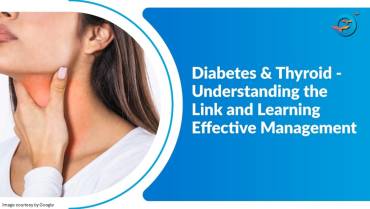 Is There a Connection Between Diabetes and Thyroid
