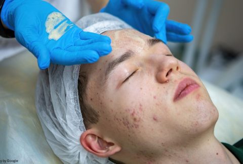 Doctor doing treatment on patient with acne
