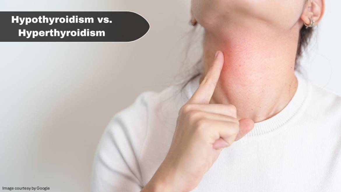 Hypothyroid vs Hyperthyroid – Know the Difference
