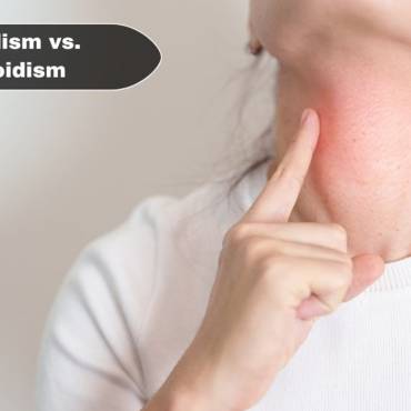 Hypothyroid vs Hyperthyroid – Know the Difference