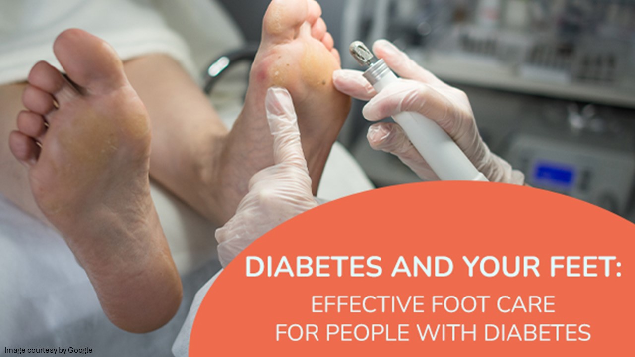 Diabetes and your feet