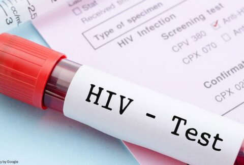 hiv test