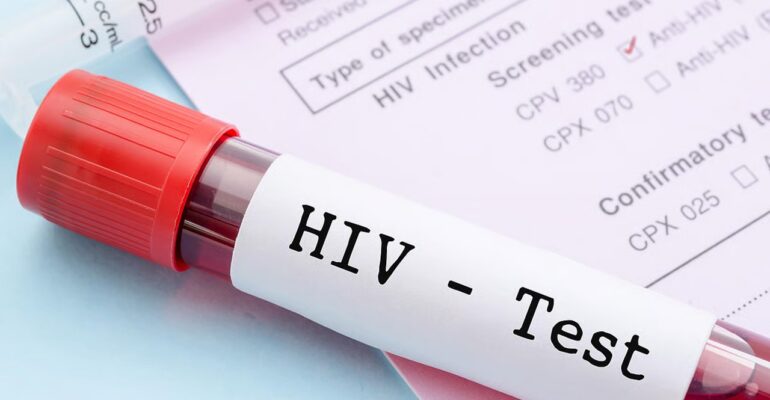 hiv test
