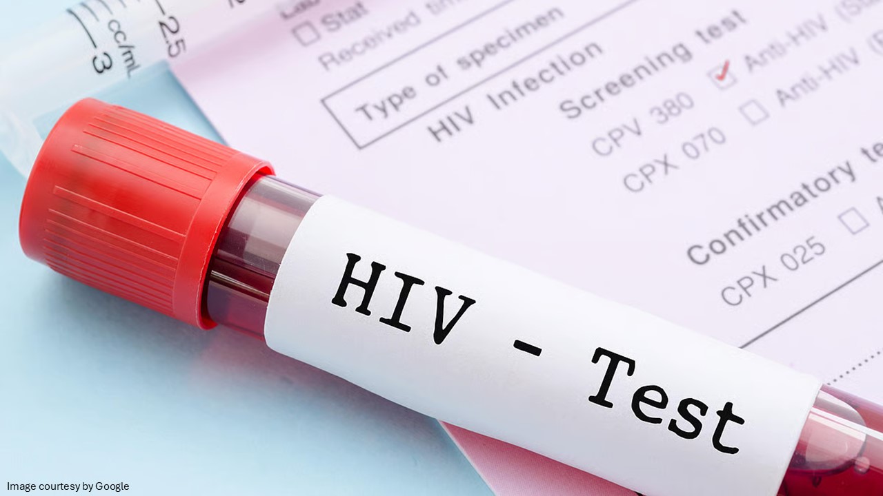 hiv test