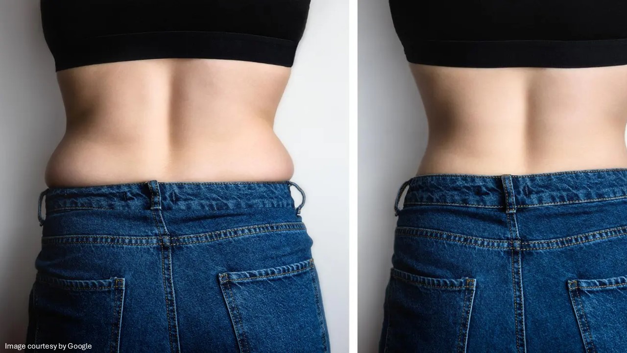 belly fat in women after 35