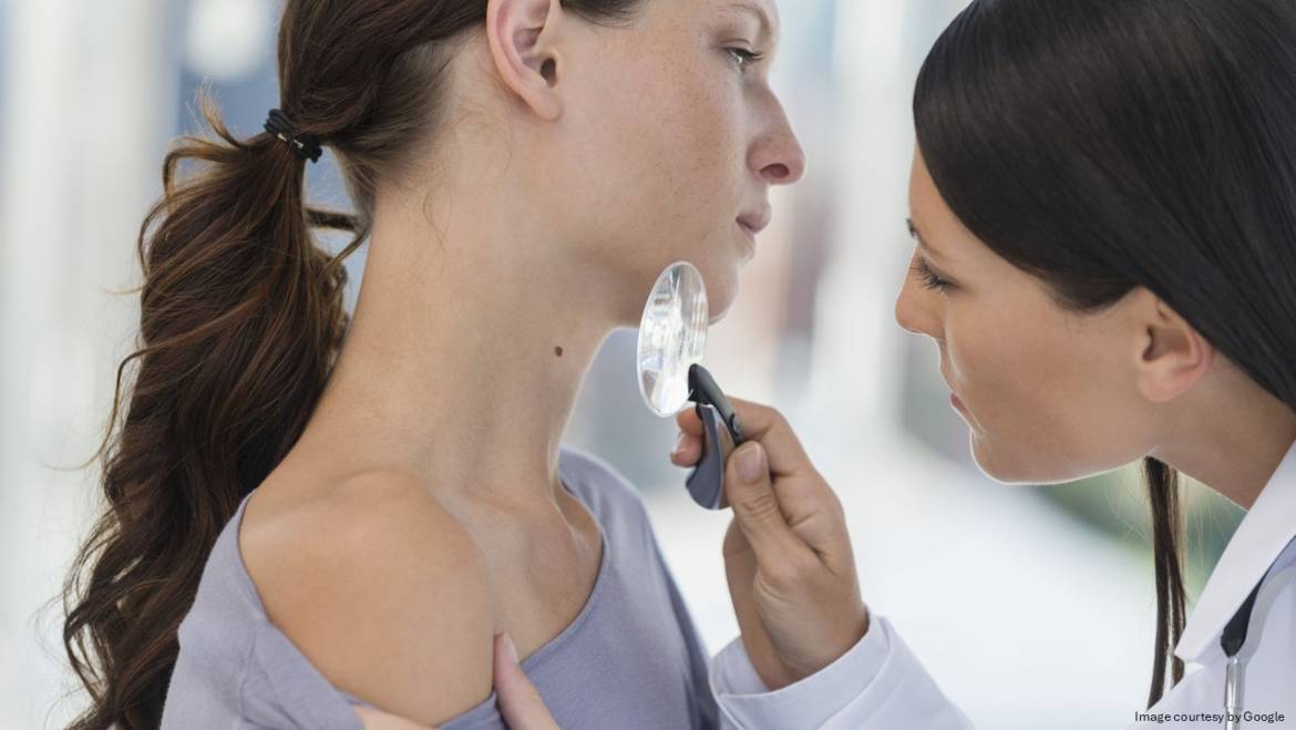 Melanoma: Understand Symptoms, Causes, Risk Factors, Prevention and More
