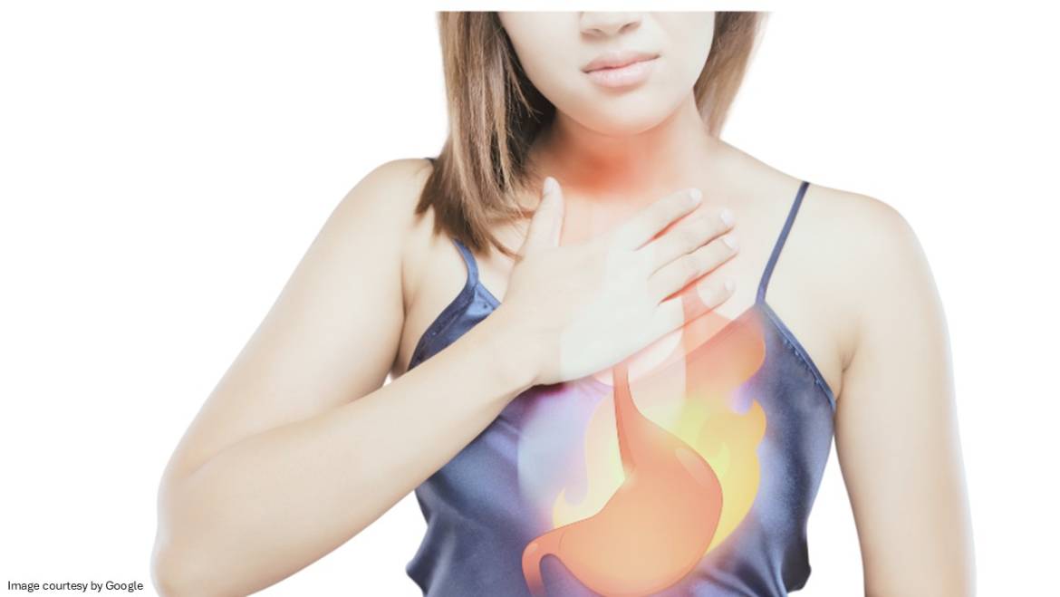 Omeprazole: Everything you need to know about this acid reflux medicine
