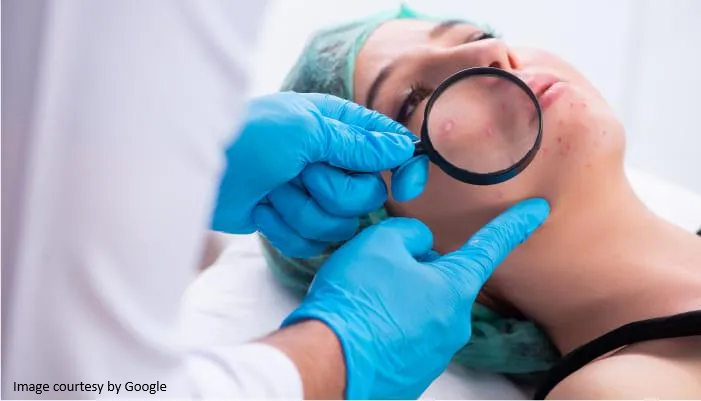 A-Ret Gel 0.025% vs 0.05% vs 0.1% — Which Strength Is Right for You?
