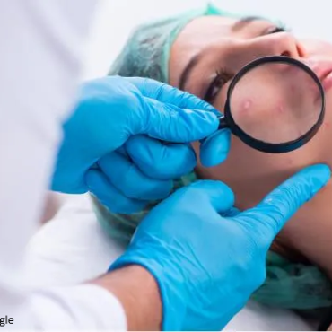 A-Ret Gel 0.025% vs 0.05% vs 0.1% — Which Strength Is Right for You?