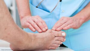 What are The Early Signs of Bunions